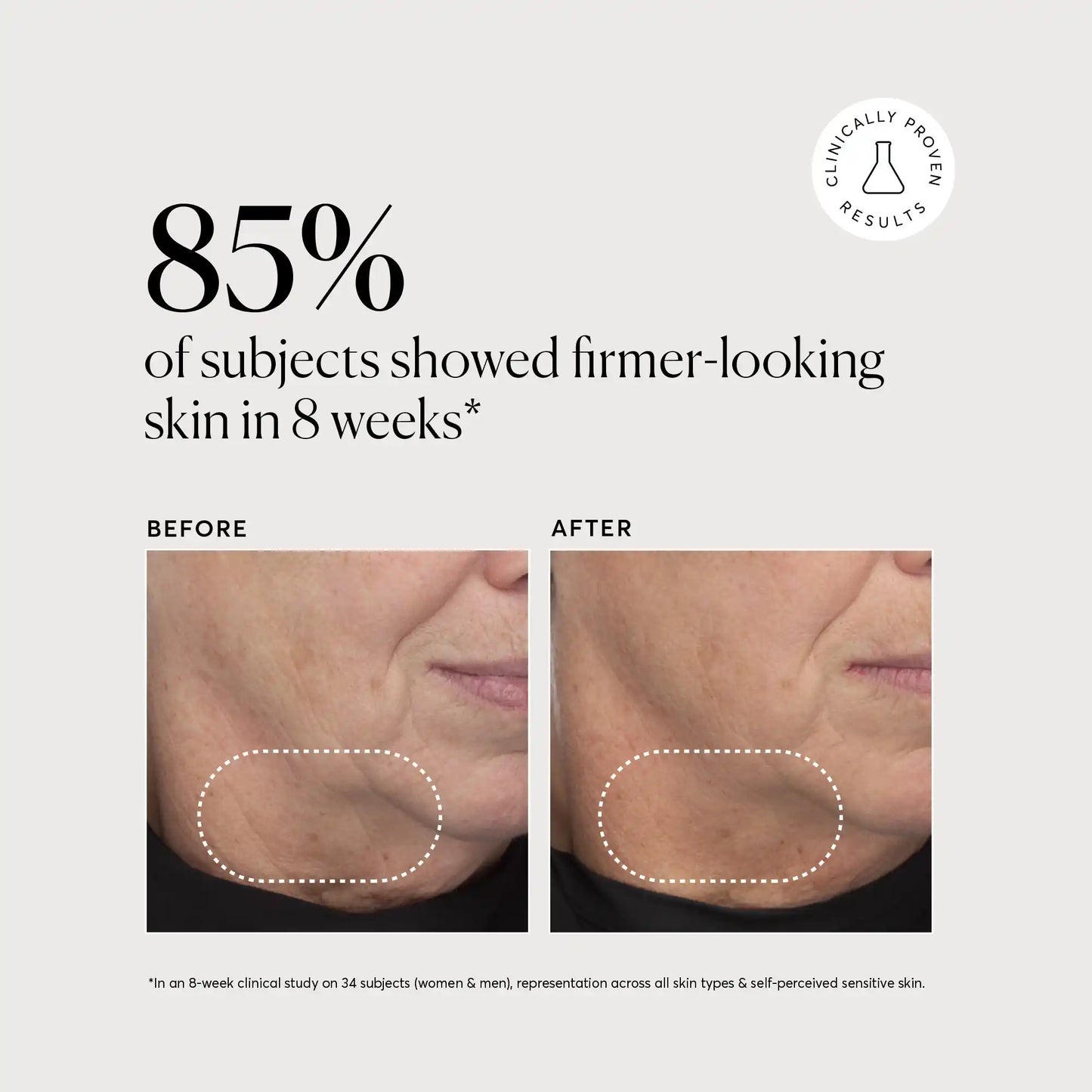 retinol-complex-serum-l2 NATR-10034-Alt-Images-Retinol-Complex-Serum-04.webp